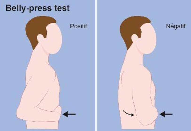 Figure 13. Belly-press test
