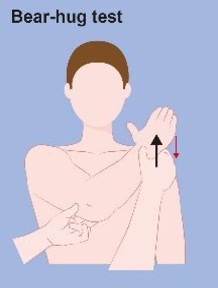Figure 14. Bear-hug test