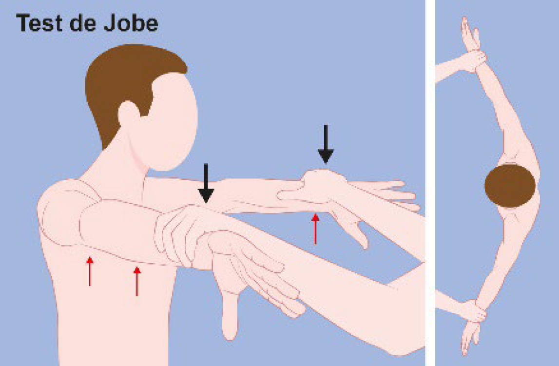 Figure 8. Test de Jobe