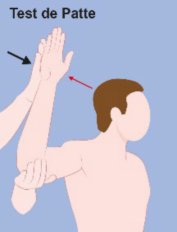 Figure 9. Test de Patte