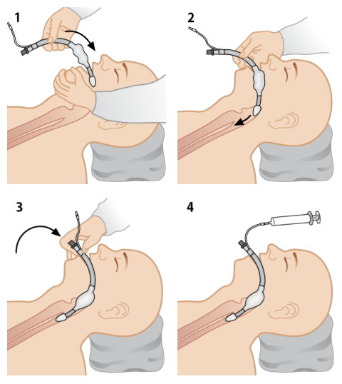 техника трубочка. трубочки из бумаги для плетения. рисование трубочкой. спиральная техника плетения из газетных трубочек. введение эндотрахеальной трубки алгоритм.